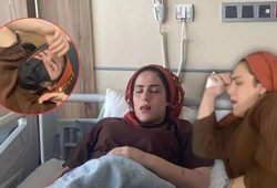 20 gündür durmadan hapşıran kadın ile ilgili kötü haber!