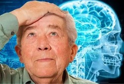 Uzmanlara göre beyni en hızlı yaşlandıran 6 basit alışkanlık