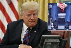 goruntuler-olay-olmustu-trumpin-hastaligini-beyaz-saray-acikladi.jpg