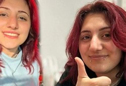 Güle oynaya ameliyata girmişti! Burun estetiği sonrası hayatını kaybetti