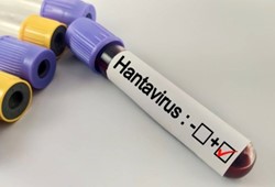 hantavirus-bir-salgina-donusur-mu-uzmanlardan-korkutan-soruya-yanit.jpg