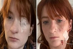 Hastaneden çıkar çıkmaz içtiği çay zehir etkisi yaptı