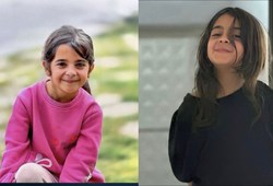 Narin'in üzerindeki kıl örnekleri bakın kimin çıktı!