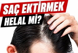 Saç ektirmek helal mi? Saç ekimi yaptırmak caiz mi?