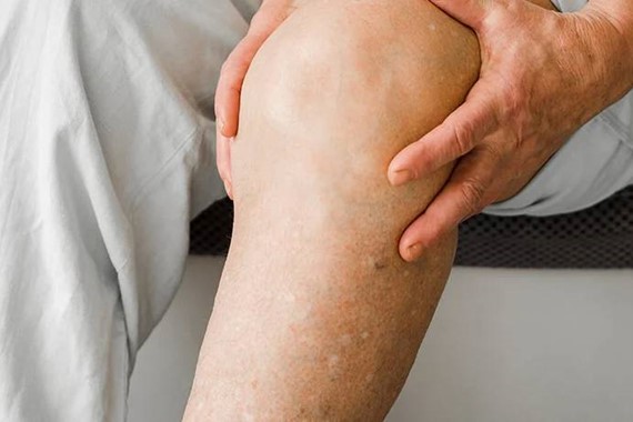 Bacaklarda Geçmeyen Şişlik ve Ağrıya Dikkat! Kilo Aldım Sandığınız Aslında...