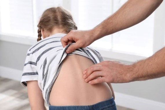 Çocuğunuzun Duruşundaki Eğrilik Masum Mu? Skolyozun Bilinmeyen İlk İşaretleri