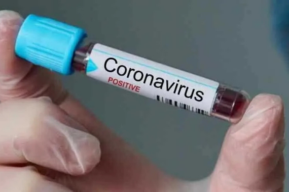 covid-19-koronavirus-nedir-koronavirus-belirtileri-nelerdir.png