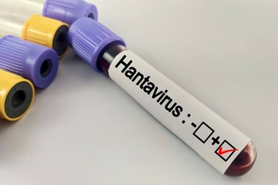 Hantavirüs Bir Salgına Dönüşür mü? Uzmanlardan Korkutan Soruya Yanıt!