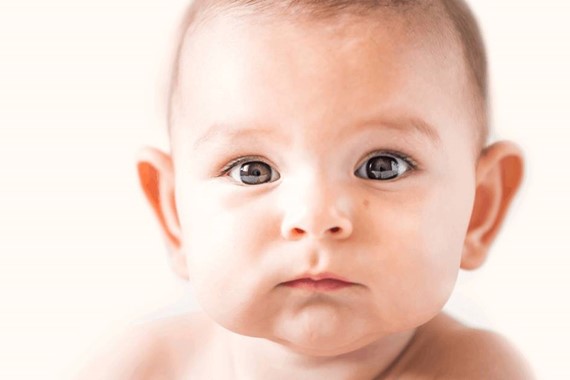 Kepçe Kulakta Yenidoğan Döneminde Ameliyatsız Tedavi Mümkün