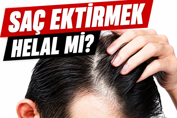 Saç ektirmek helal mi? Saç ekimi yaptırmak caiz mi?