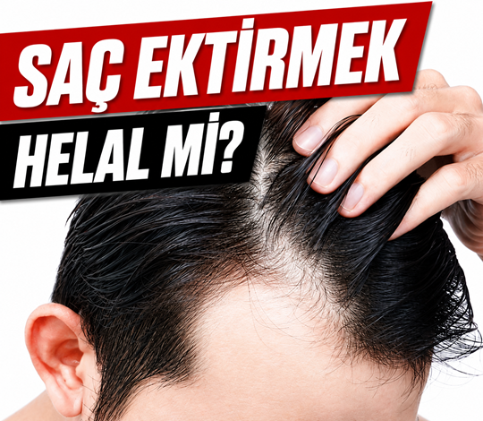 Saç ektirmek helal mi? Saç ekimi yaptırmak caiz mi?