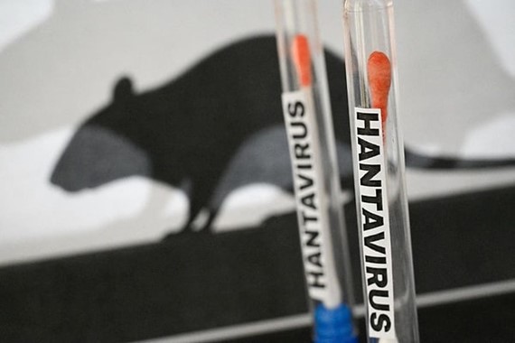 hantavirus-gemi.jpg