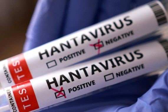 hantavirus-her-yil-goruluyor.jpg