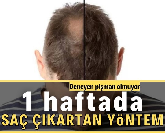 1 haftada saç çıkartan yöntem! Deneyen pişman olmuyor