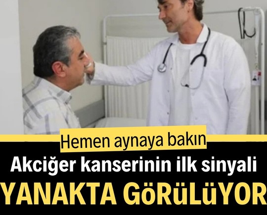 Akciğer kanserinin ilk sinyali yanakta görülüyor! Hemen aynaya bakın