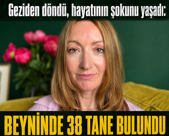 Geziden döndü, hayatının şokunu yaşadı: Beyninde 38 tane bulundu