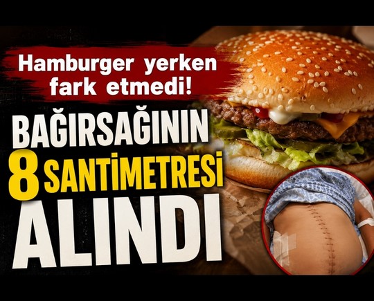 Hamburger yerken fark etmedi! Bağırsağının 8 santimetresi alındı