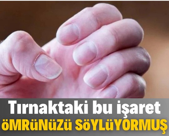 Harvard’lı uzmandan çarpıcı açıklama! Tırnaktaki bu işaret ömrünüzü söylüyor!