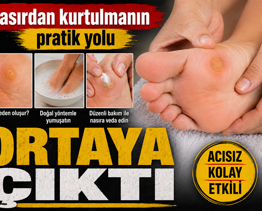 Nasırdan kurtulmanın pratik yolu ortaya çıktı
