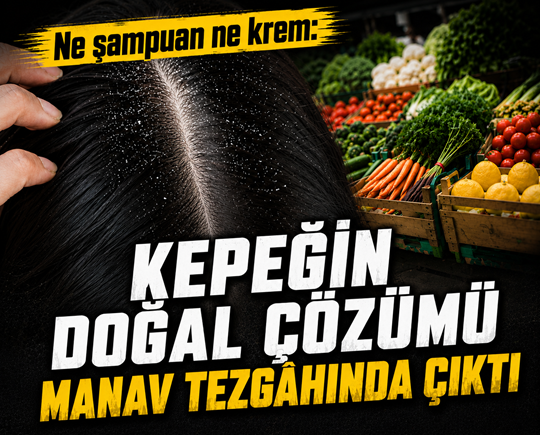 Ne şampuan ne krem: Kepeğin doğal çözümü manav tezgâhında çıktı