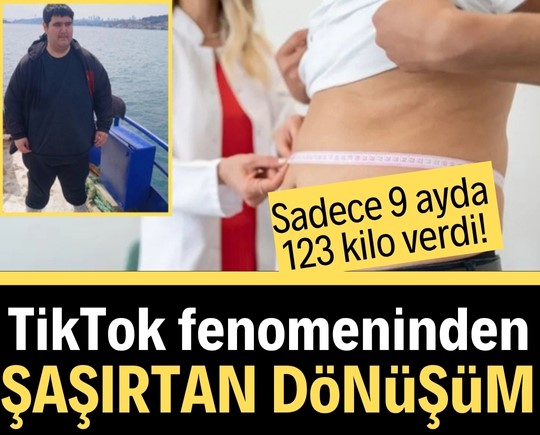Sadece 9 ayda 123 kilo verdi! TikTok fenomeninden şaşırtan dönüşüm